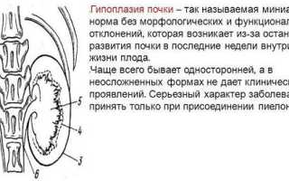 Викарная гипертрофия и гиперплазия почки: увеличение столба