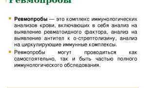 Про анализ крови на ревмопробы и его расшифровка