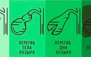 Какие используют желчегонные препараты при перегибе жёлчного пузыря