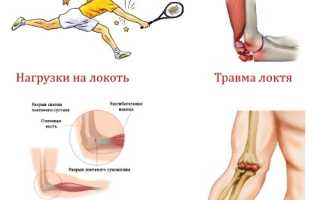 Что делать, если болит локоть левой руки