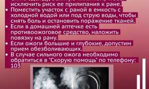 Как оказать первую помощь при ожоге кипятком