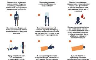 О правилах наложения шин