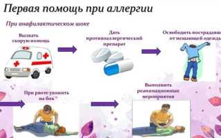 Оказание первой помощи при аллергии