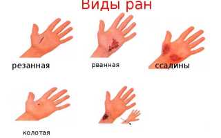 Оказание первой помощи при ранениях
