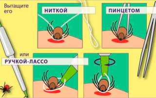 Оказание помощи при укусе клеща