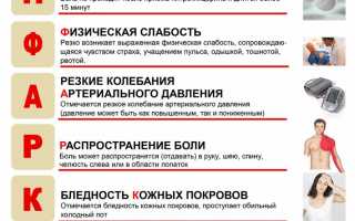 Оказание первой помощи при инфаркте