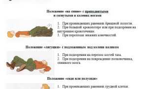 Все способы транспортировки пострадавших