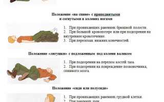 Все способы транспортировки пострадавших