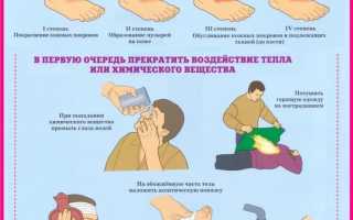 Неотложная помощь при ожоговом шоке