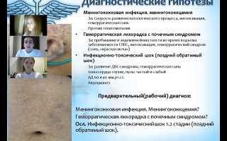 Неотложная помощь при инфекционно-токсическом шоке