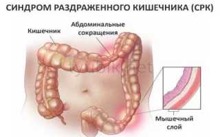 Зачем рекомендован прием Тримедата при воспалении поджелудочной железы