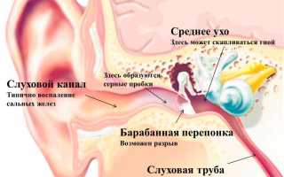 Что необходимо делать, если болит ухо?