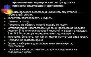 Оказание неотложной помощи при желудочном кровотечении