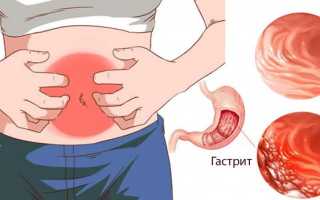 Питание при ГЭРБ (рефлюкс эзофагите пищевода): меню на каждый день