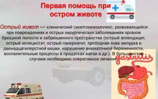 Оказание неотложной помощи при остром животе