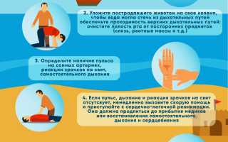 Оказание первой помощи при утоплении