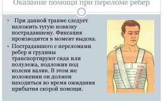 Оказание первой помощи при переломе ребер