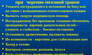 О первой помощи при черепно-мозговой травме (ЧМТ)