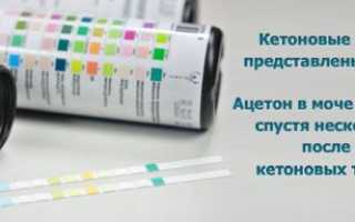 Ацетон в моче при беременности — симптомы, диагностика, лечение