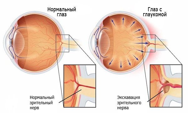 Голдлайн плюс. Инструкция по применению, отзывы худеющих, фото до и после