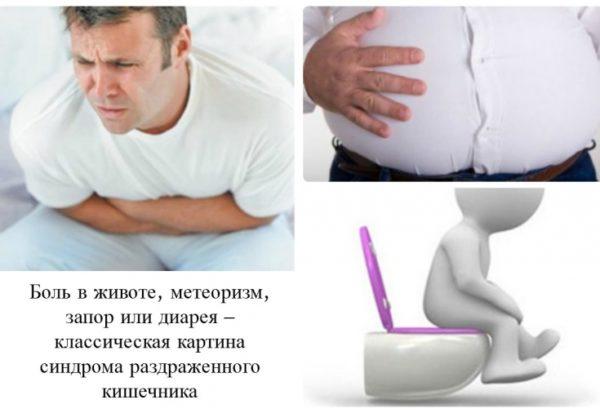 Характерные симптомы синдрома раздраженного кишечника