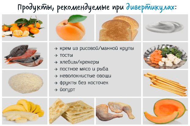 Какой должна быть диета при дивертикулезе кишечника