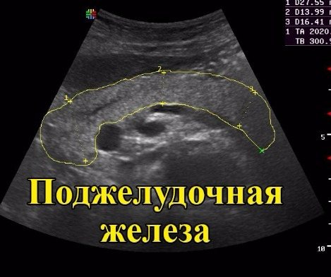 Ультразвуковое изображение поджелудочной железы без каких-либо заболеваний