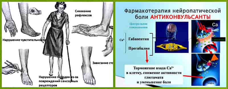 лечение препаратами