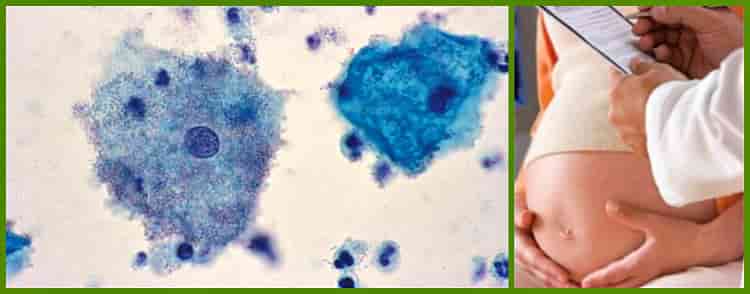 при беременности