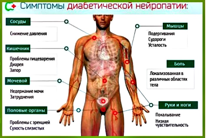 признаки