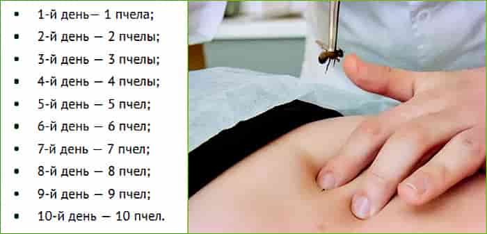 схема лечения по дням