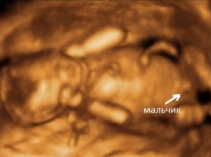 Мальчик на 3d УЗИ