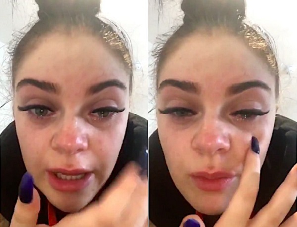 Девушка с реакцией на клей после наращивания ресниц